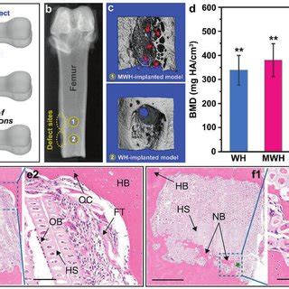 Osteoconduktief Hydrogel Voor Beenderherstel: Een Revolutionaire Benadering?